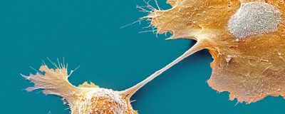 Immune cell-mediated killing of A549 cancer target cells in real-time